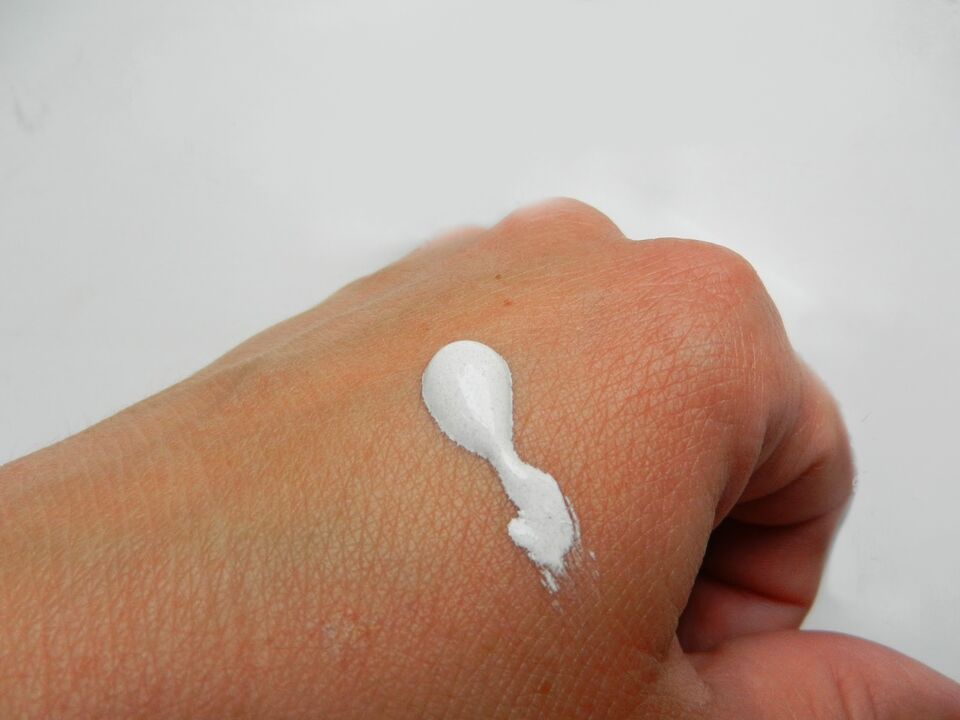 Photo of intenskin cream on hand from the review by Elizabeth of Dublin