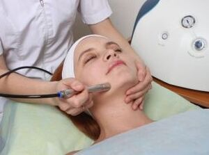Laser rejuvenation of the face