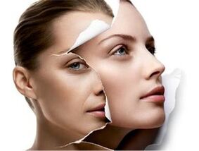Rejuvenation of the skin