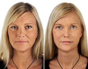before and after