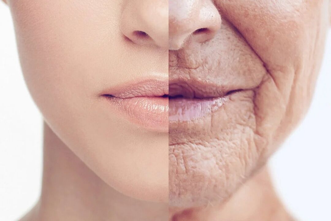 Deterioration of skin with age