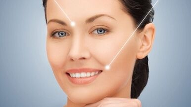Result after fractional laser skin rejuvenation