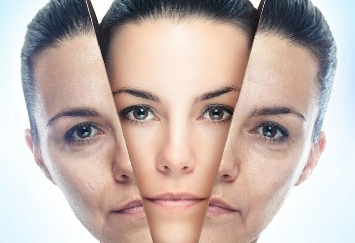 Rejuvenation of facial skin