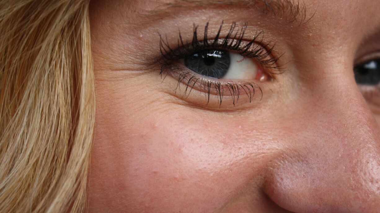 The appearance of wrinkles is a natural process