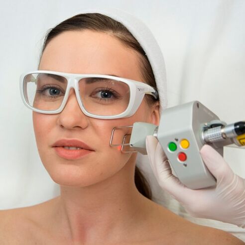 Fractional laser rejuvenation process that removes fine wrinkles