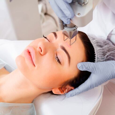 Photothermolysis procedure to rejuvenate the skin of the face